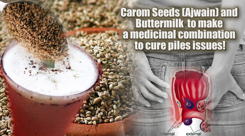 Carom Seeds (Ajwain) and Buttermilk to cure piles issues!