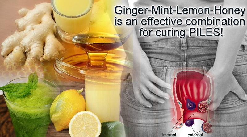 Usefulness of Ginger-Mint-Lemon-Honey mixture in curing piles issues!