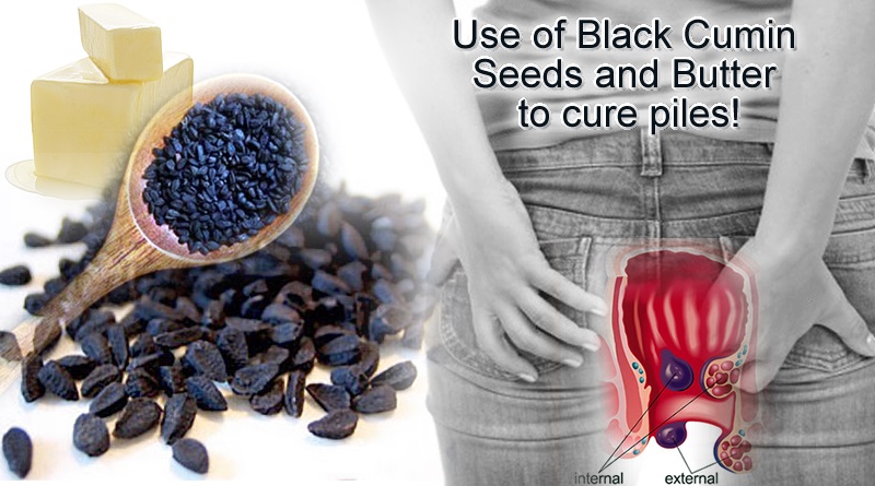 Use of Black Cumin Seeds and Butter to cure piles related issues!