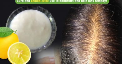 Curd and Lemon Juice use in dandruffs and hair loss remedy!