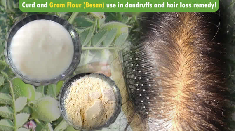 Curd and Besan (Gram Flour) use in dandruffs and hair loss remedy!