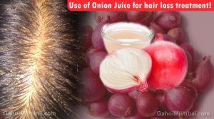 Information about Use of Use of Onion Juice for hair loss treatment!