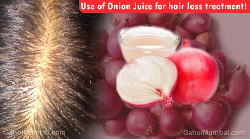 Use of Onion Juice for hair loss treatment! – GAHOIMUMBAI