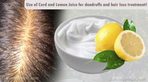 Information about Use of Curd and Lemon Juice for dandruffs and hair loss treatment!