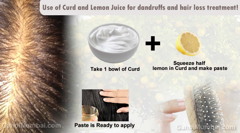 Information about Use of Curd and Lemon Juice for dandruffs and hair loss treatment!